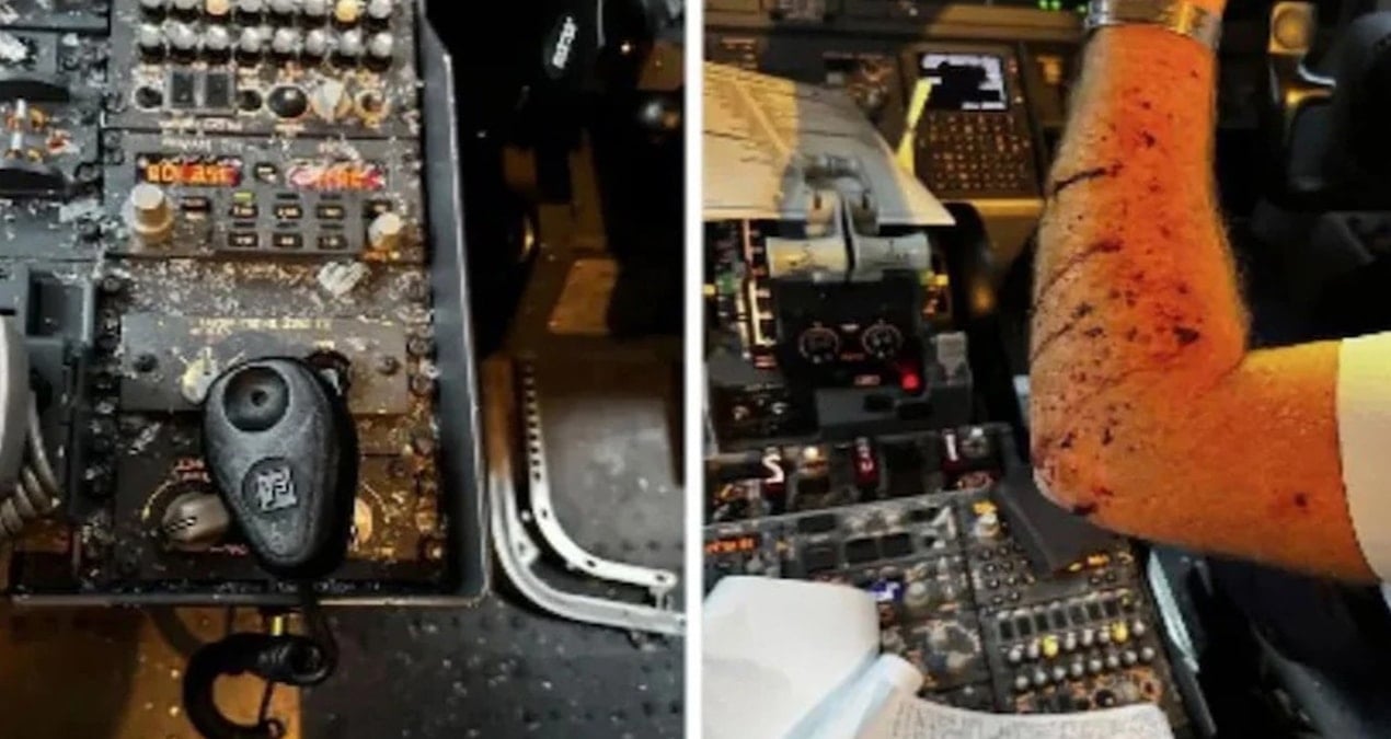 yolcu ucagina meteor carpti kokpit parcalandi pilot kanlar icinde kaldi 9ypRQxl2.jpg